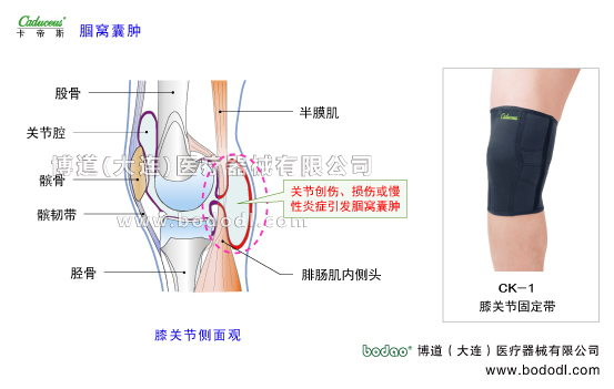 膝關(guān)節(jié)的運動損傷與防護(hù)