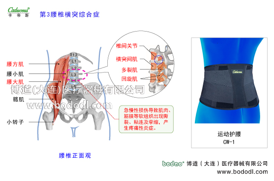 腰椎部的運動損傷與防護