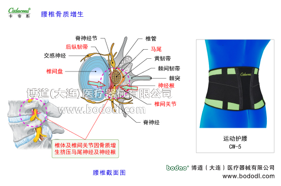 腰椎部的運動損傷與防護