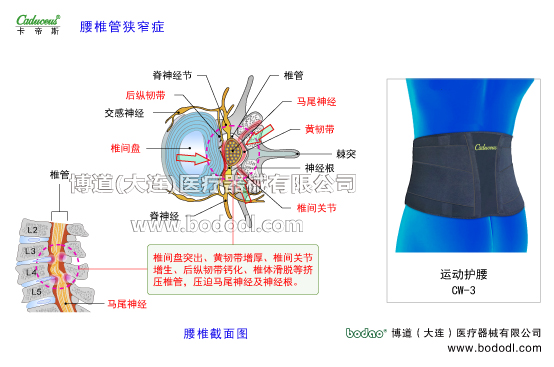 腰椎部的運動損傷與防護