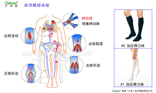 肌肉痙攣與加壓防護(hù)