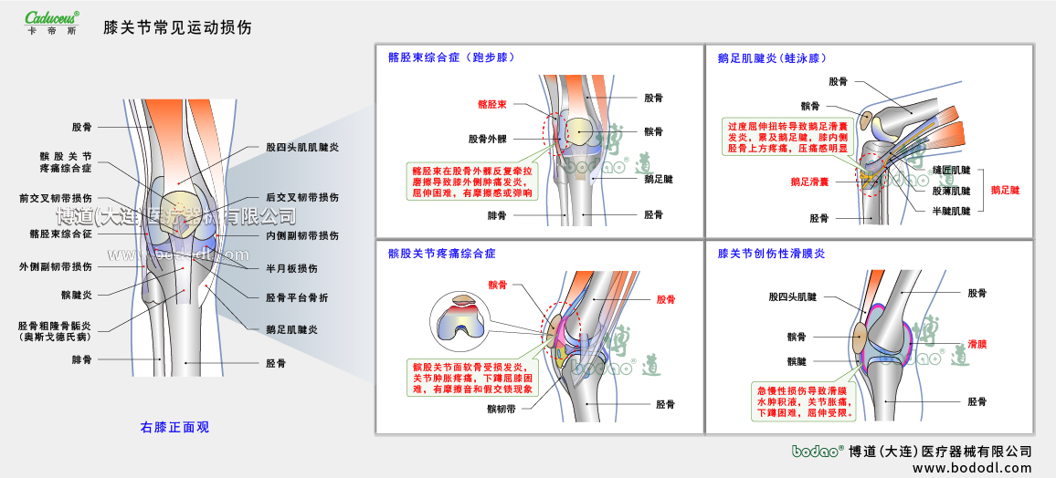 膝關(guān)節(jié)運(yùn)動(dòng)損傷的類型與癥狀