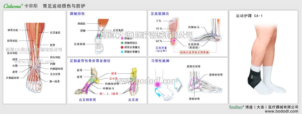 足首の主なスポーツ損傷