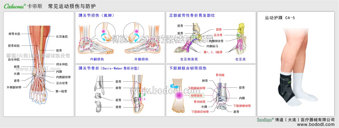 足首の主なスポーツ損傷