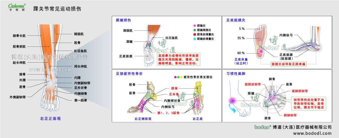 踝關(guān)節(jié)運(yùn)動損傷的類型與癥狀