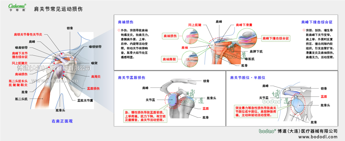 肩關(guān)節(jié)運動損傷的類型與癥狀