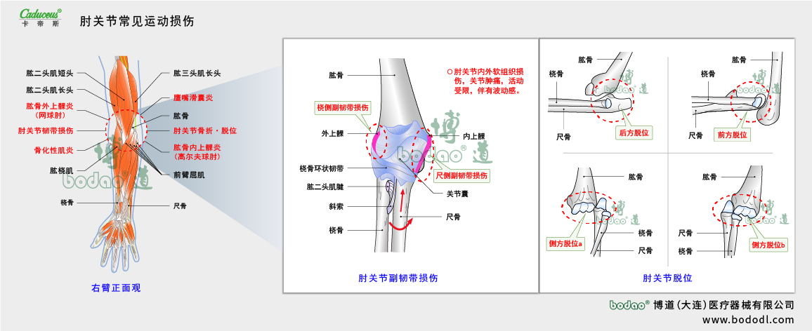 肘關(guān)節(jié)運(yùn)動(dòng)損傷的類型與癥狀