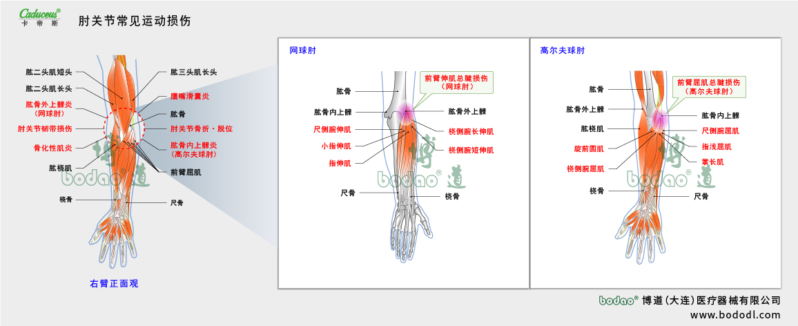 肘關節(jié)運動損傷的類型與癥狀