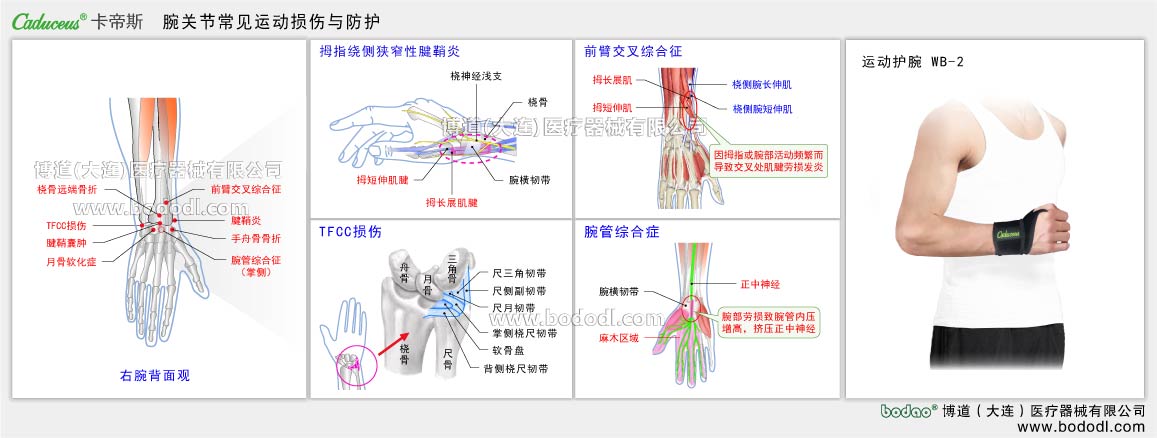 手関節(jié)の主なスポーツ損傷