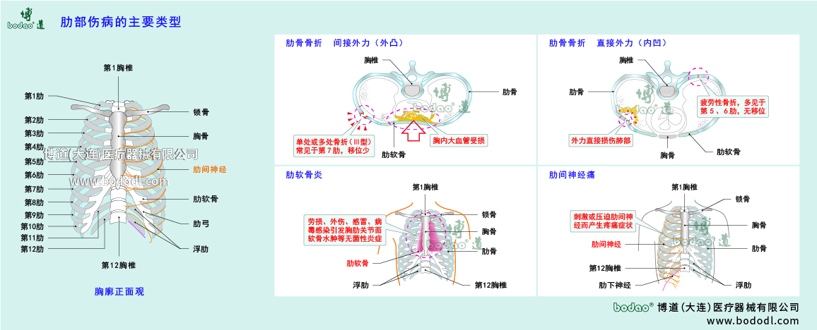 肋部傷病的類型與癥狀