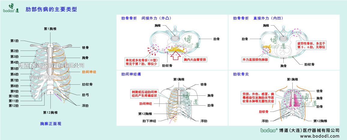 肋部傷病的類型與癥狀
