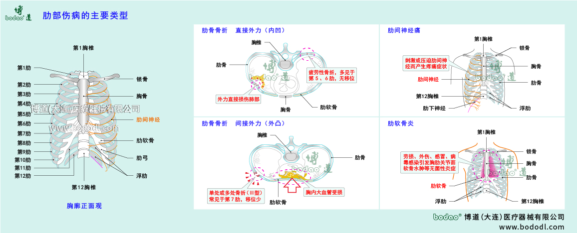 肋部傷病的類型與癥狀
