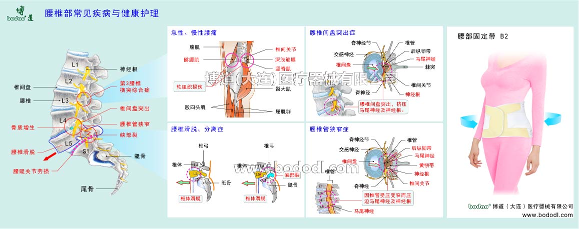 腰部の主な疾患