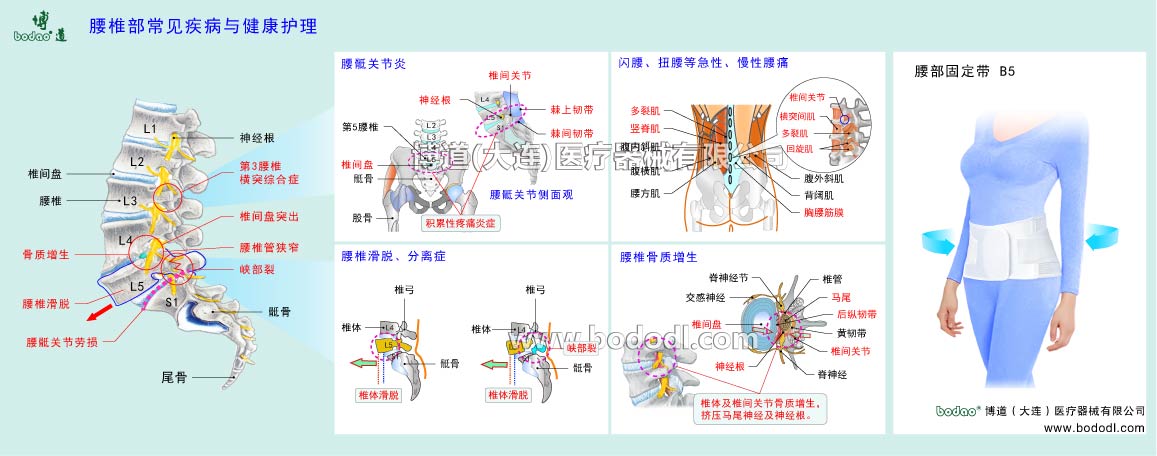 腰部の主な疾患