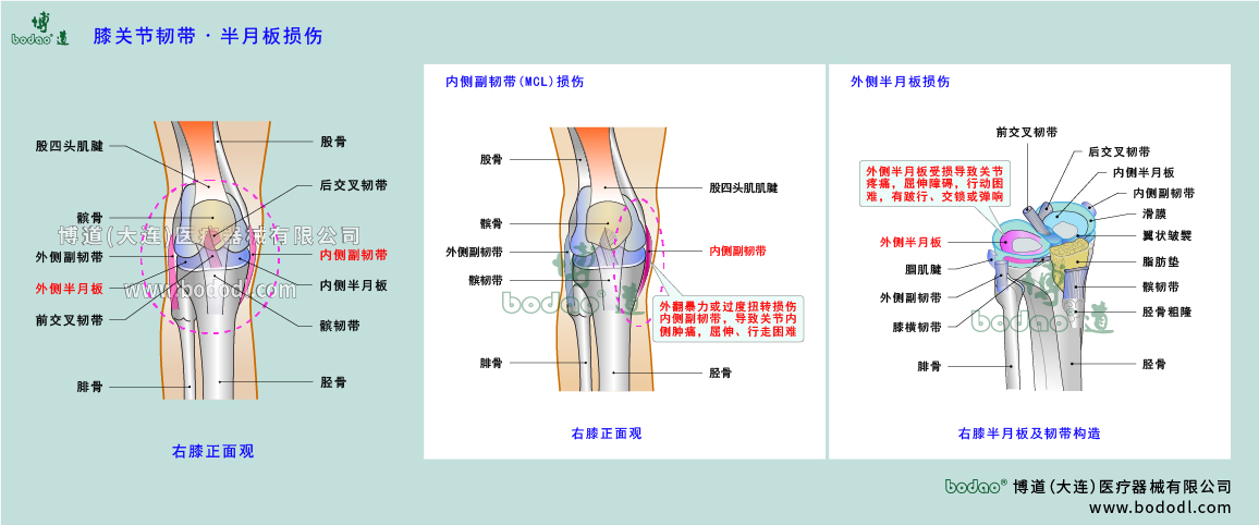 膝關(guān)節(jié)疾病的類(lèi)型與癥狀