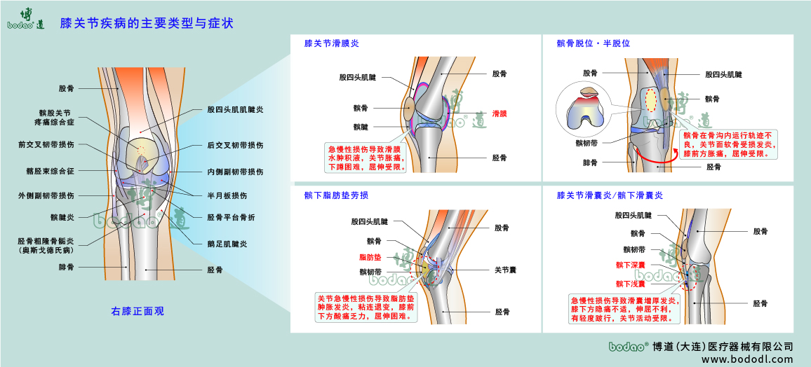 膝關(guān)節(jié)疾病的類型與癥狀