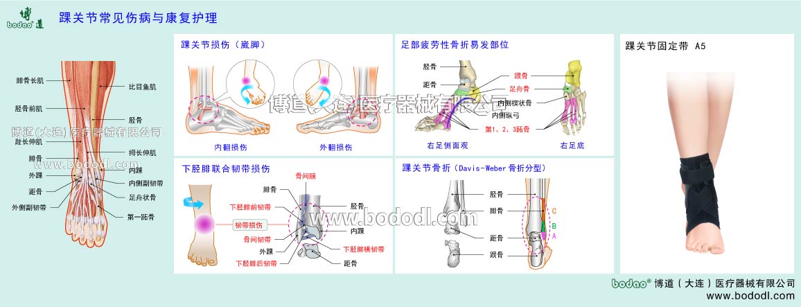 足首の主な疾患