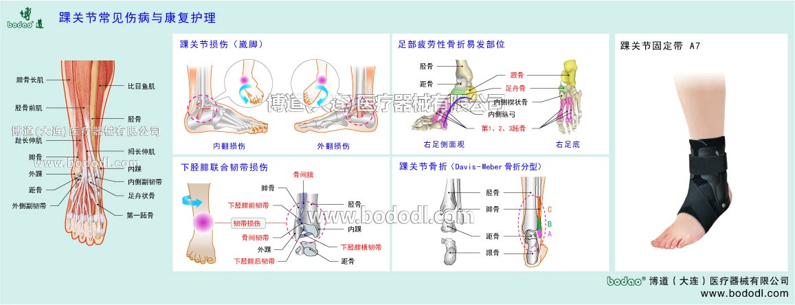 足首の主な疾患