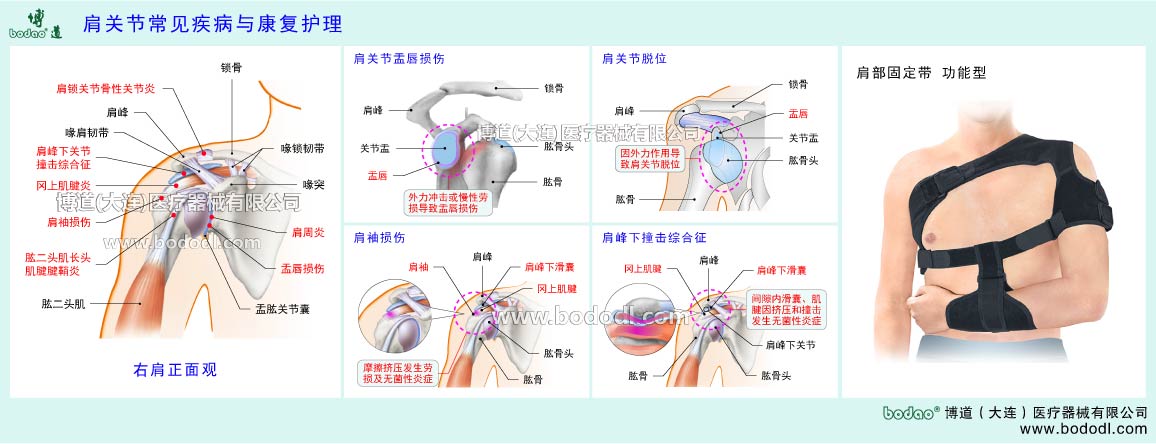 肩関節(jié)の主な疾患