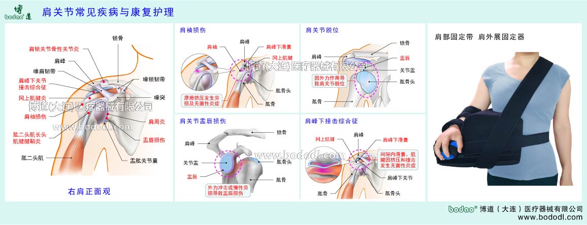 肩関節(jié)の主な疾患
