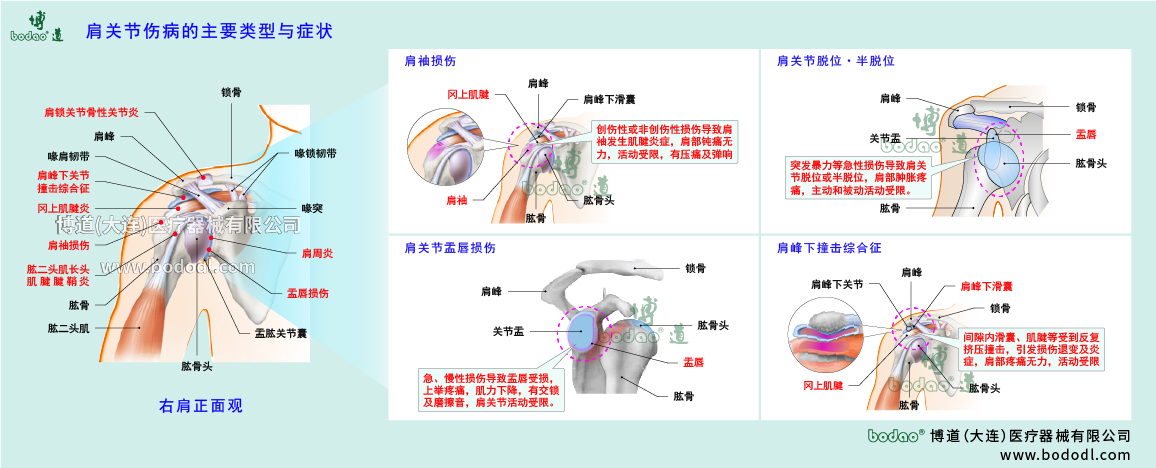 肩關節(jié)傷病的類型與癥狀