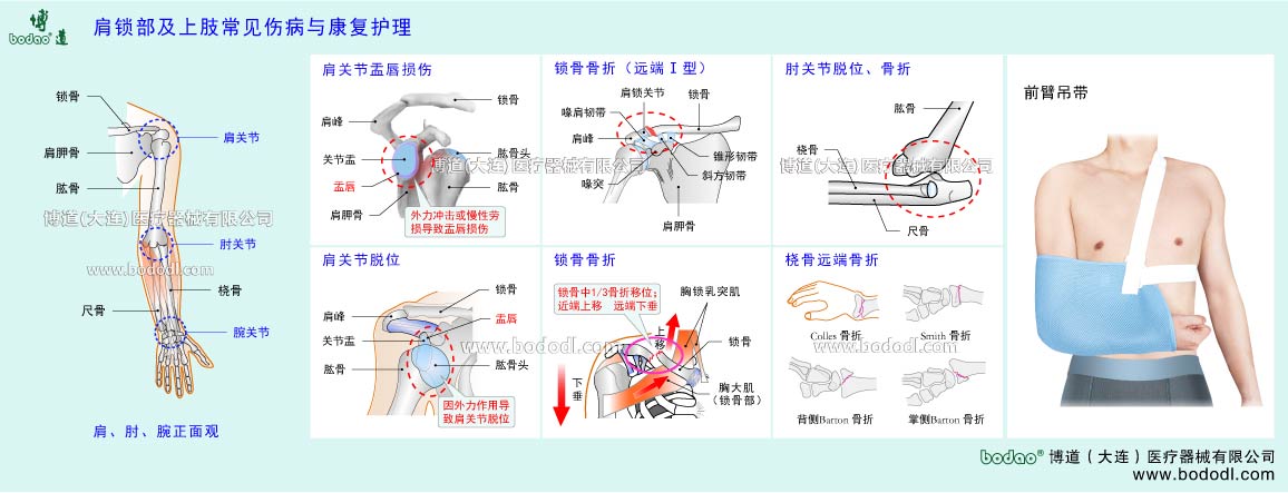 上肢骨の主な疾患