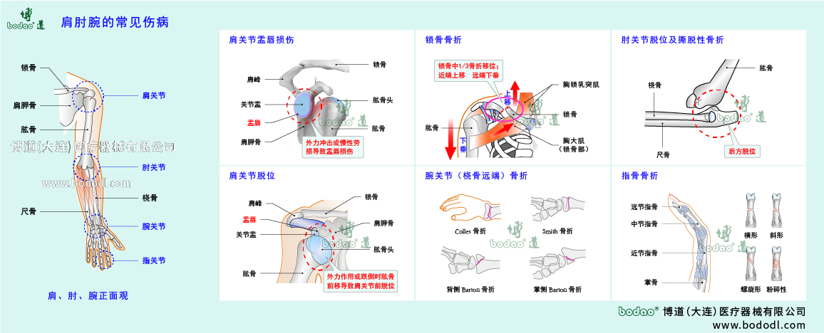 肩肘腕傷病的類(lèi)型與癥狀