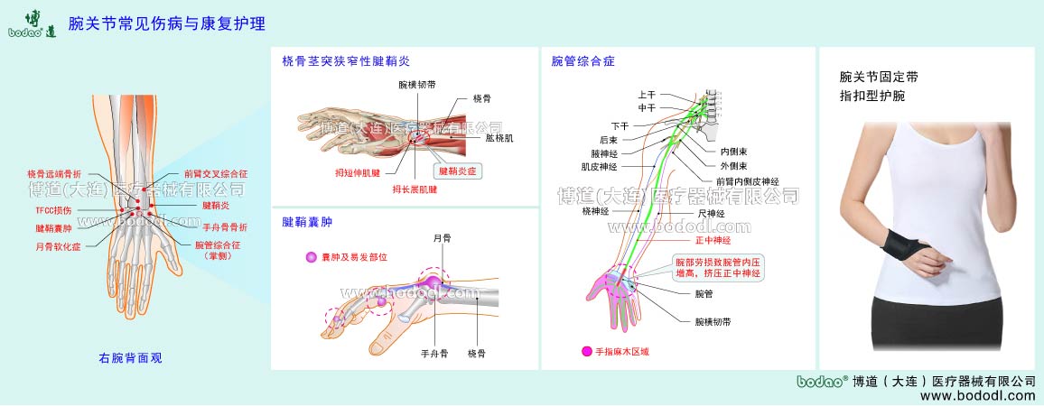 手関節(jié)の主な疾患