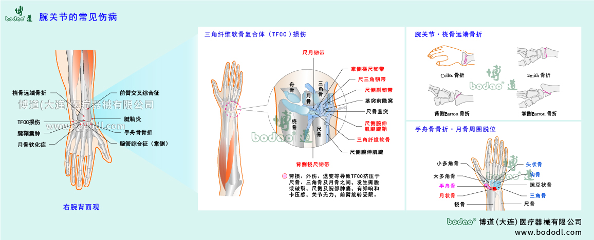 腕關(guān)節(jié)傷病的類型與癥狀