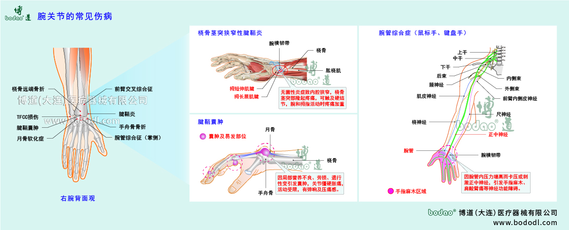 腕關(guān)節(jié)傷病的類型與癥狀