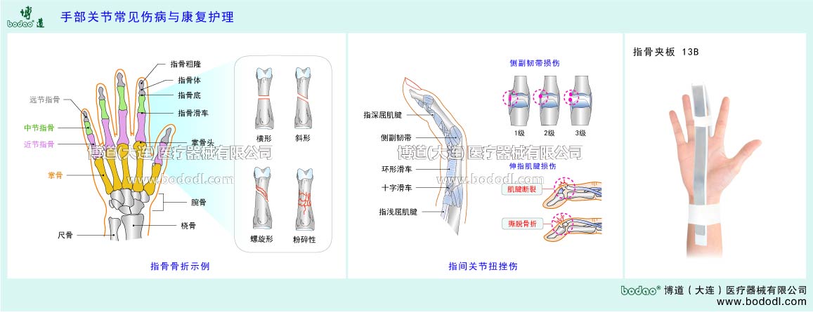 指関節(jié)の主な疾患