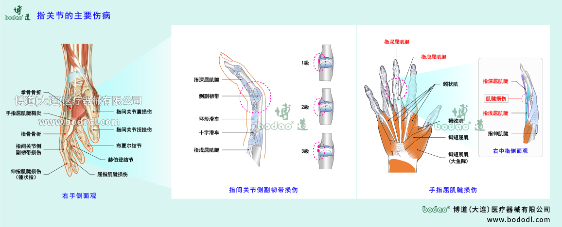 指關(guān)節(jié)傷病的類型與癥狀