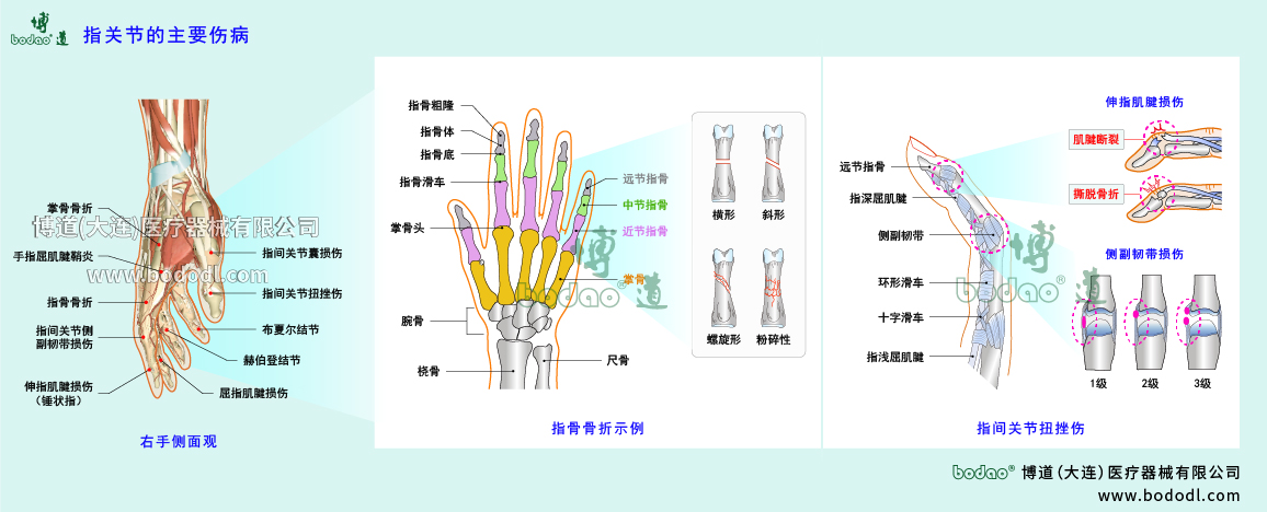指關(guān)節(jié)傷病的類(lèi)型與癥狀