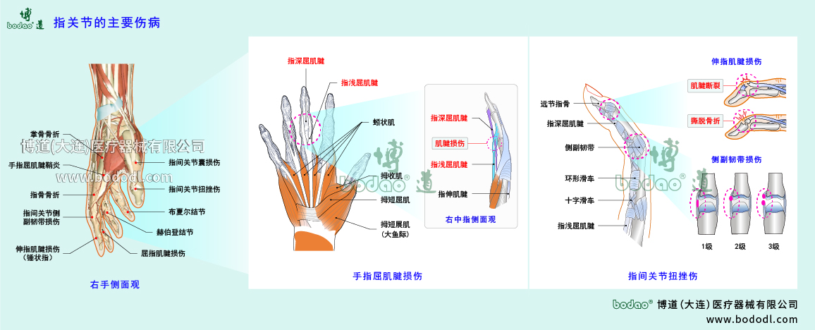 指關(guān)節(jié)傷病的類型與癥狀
