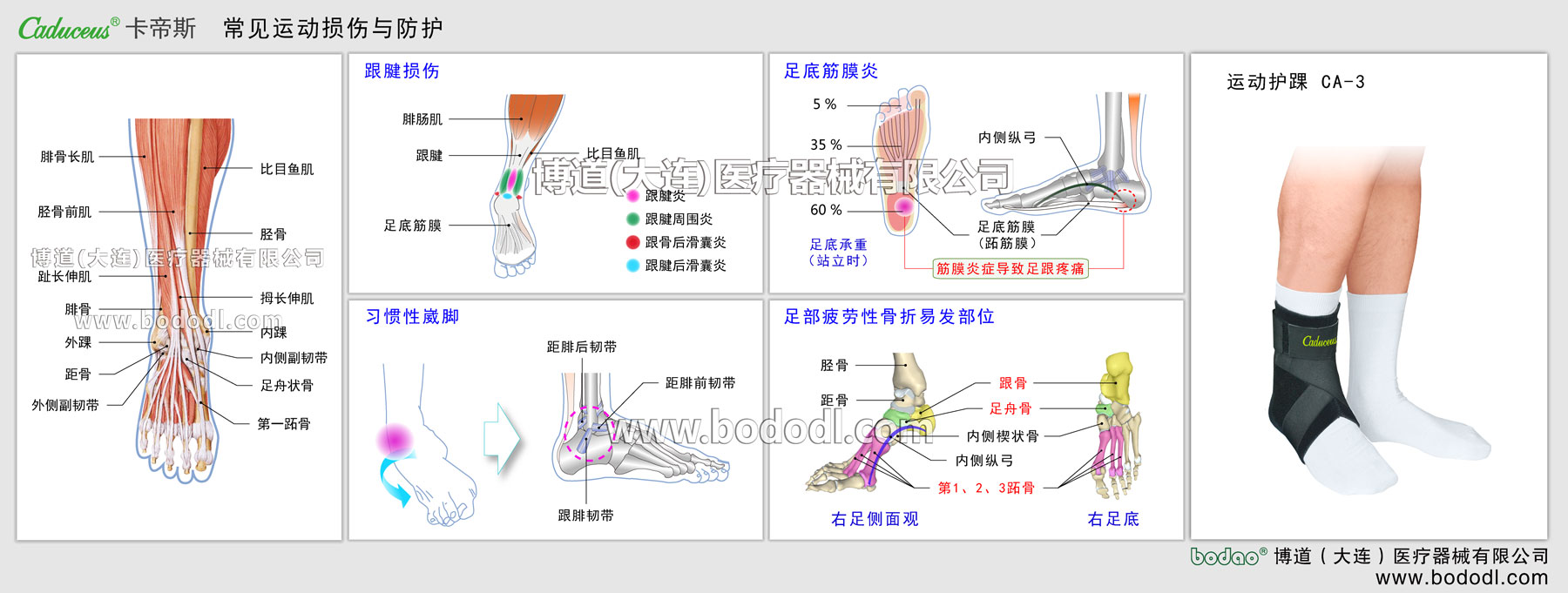 足首の主なスポーツ損傷